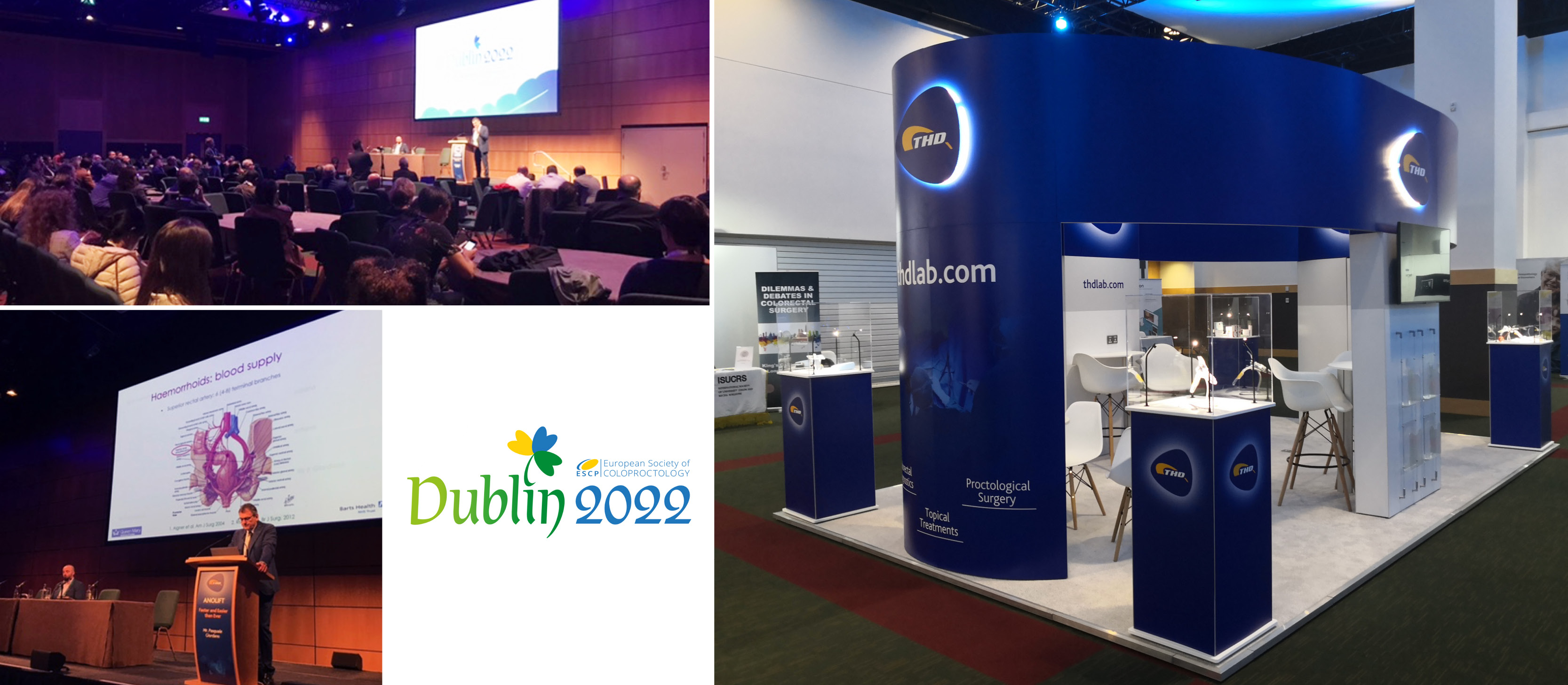 Dal 21 al 23 settembre 2022 THD era a Dublino per partecipare al Congresso Annuale della Società Europea di Coloproctologia (ESCP).